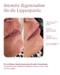 Plumping Lip Care 2024