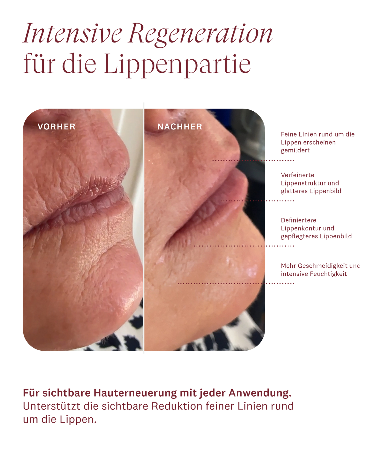 Plumping Lip Care 2024