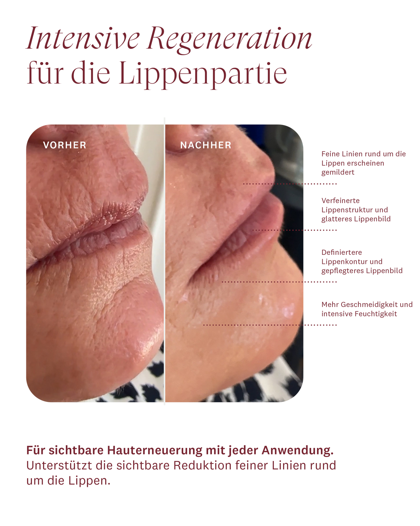 Plumping Lip Care (Member Special)
