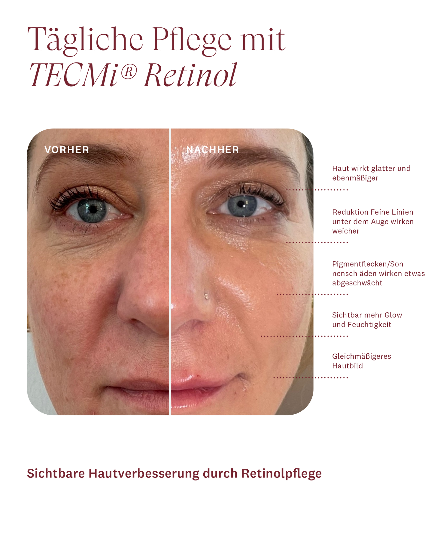 Refining Day Cream (Member Special)