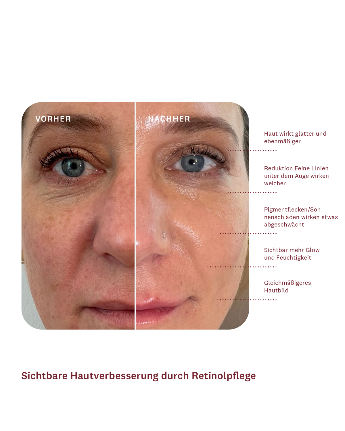 Daily 24h Retinol Routine Day & Night 2026