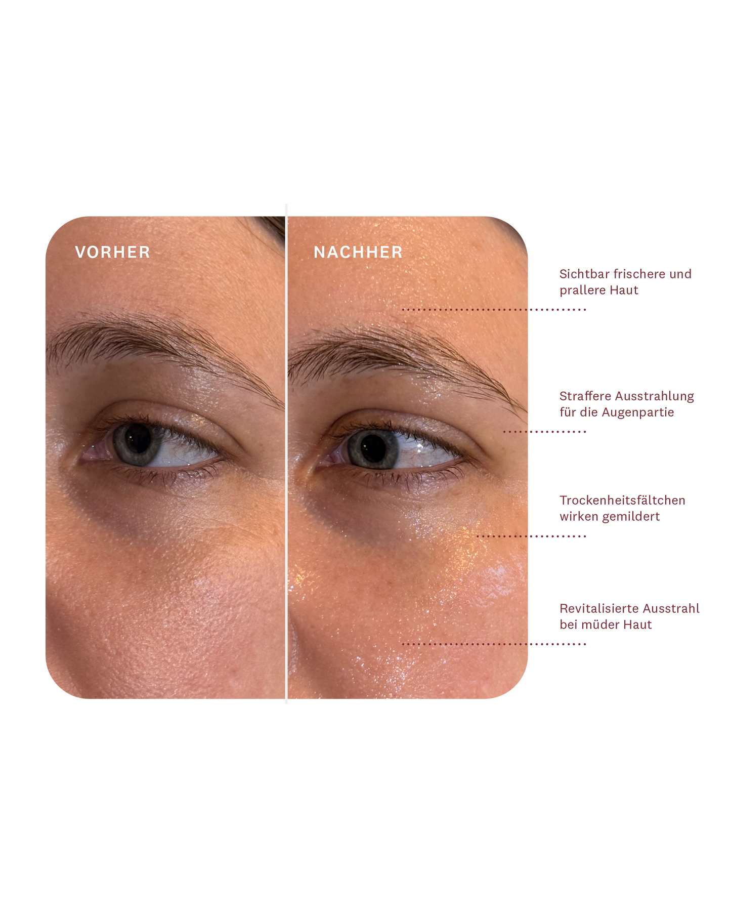 The Lift Activator Ampoule